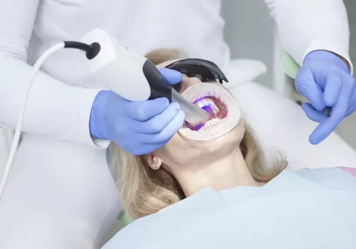 Os Beneficios do Scanner Intraoral para Pacientes Uma Revolucao na Odontologia