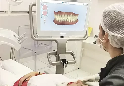 Scanner intraoral